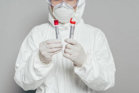 В Україні кількість хворих на коронавірус зросла