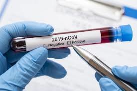 Щодня в Україні додаються випадки захворювання на COVID-19  