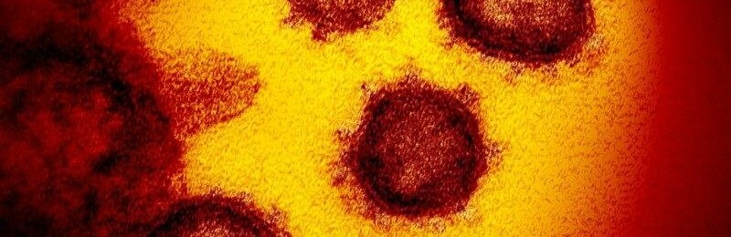 Перший випадок захворювання на коронавірус зафіксували в Україні Перший випадок захворювання на коронавірус зафіксували в Україні