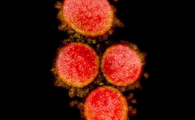 У запорізькому регіоні виявили підозрілих на коронавірусну інфекцію