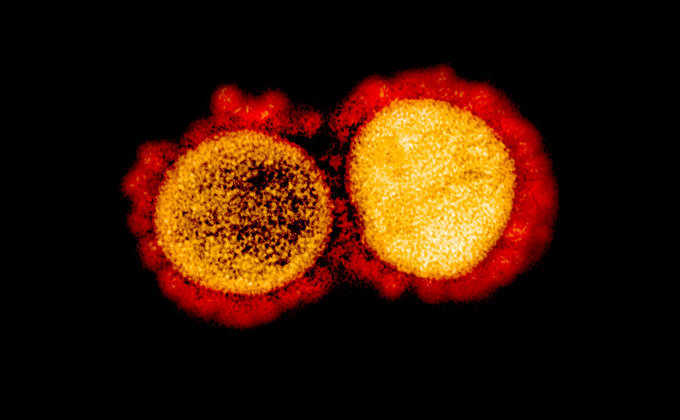 Поки жодного підтвердження захворювання на коронавірус в Запоріжжі немає