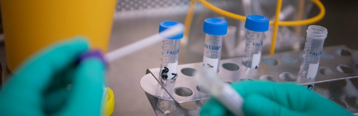 У Токмаці виявили дівчину з підозрою на коронавірус  У Токмаці виявили дівчину з підозрою на коронавірус