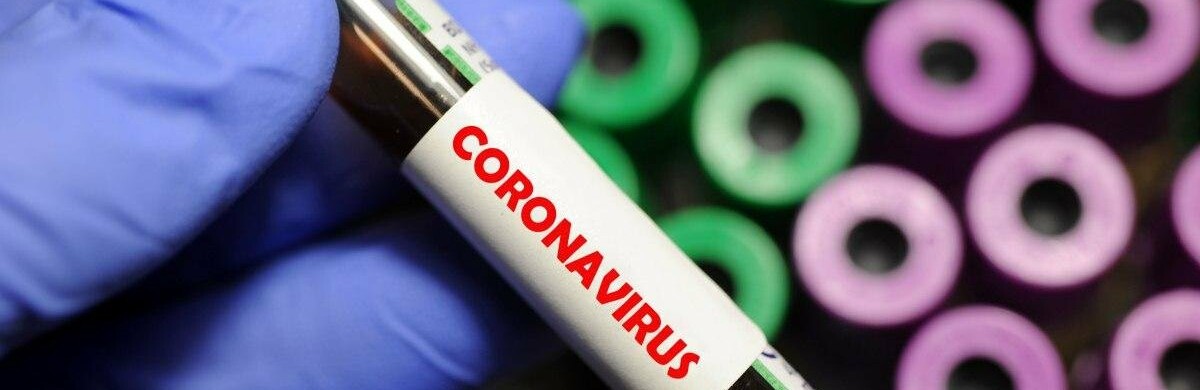 Нові дані щодо інфікованих на коронавірус у Запорізькій області