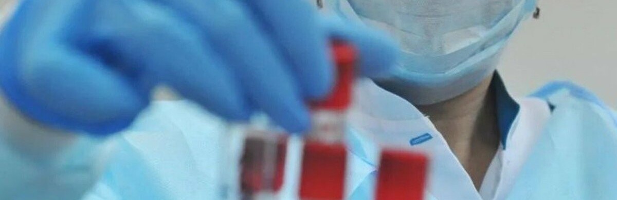 Ще 10 нових випадків хвороби на коронавірус зареєстровано в Запорізькій області за добу 