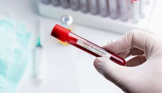 У Токмацькому районі посилили заходи протидії розповсюдженню коронавірусу