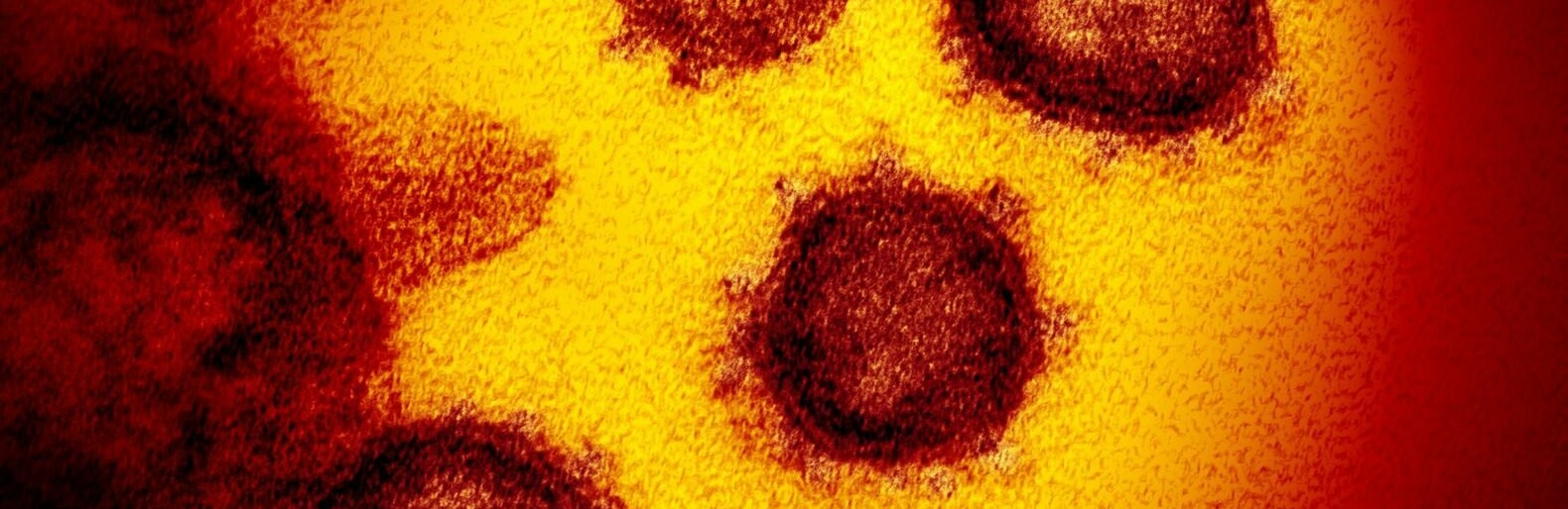 У Запорізькій області вже більше сотні хворих на коронавірус 